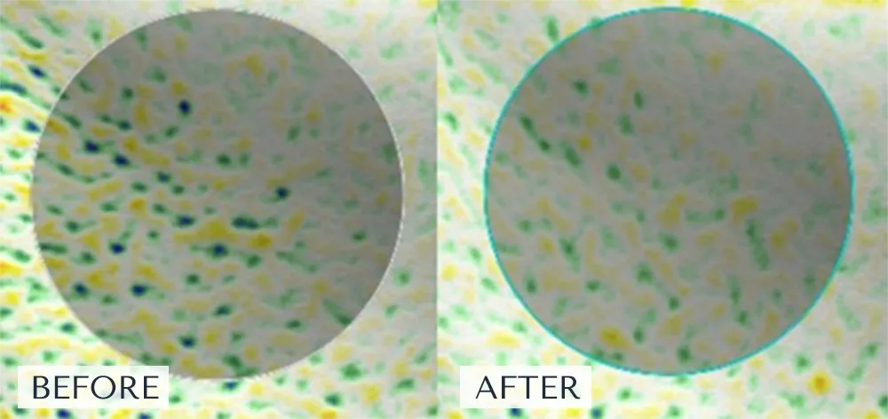 キメの乱れが軽減された