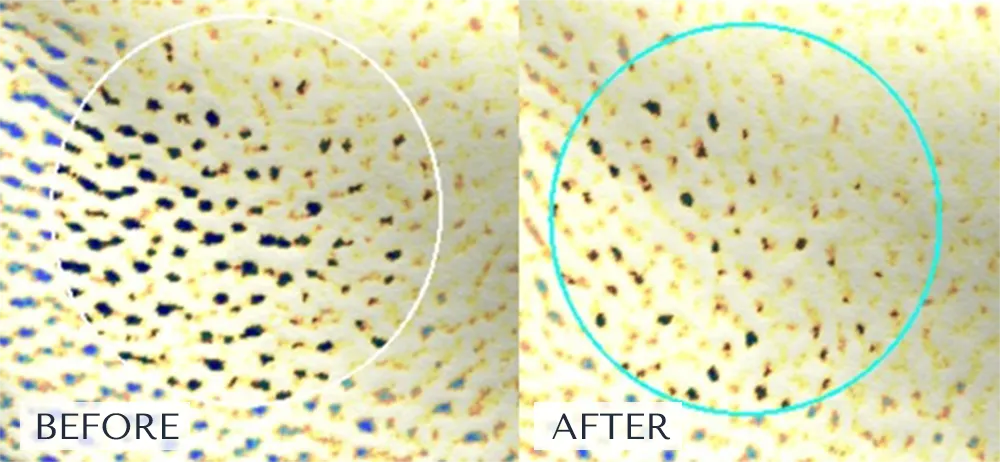 毛穴の目立ちの軽減