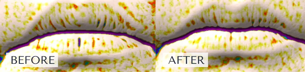 唇のシワが減少